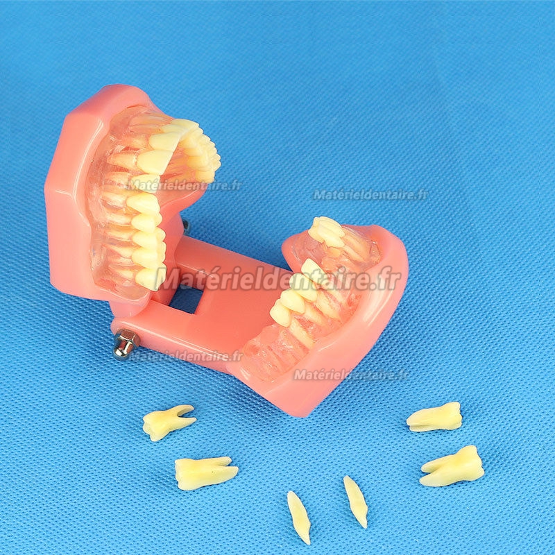 YZDKJDZ Modèle De Dents, Modèle De Dent Orale Orthodontique avec 32 Dents  Amovibles, Modèle De Gencive Molle pour Typodont, pour Démonstration De